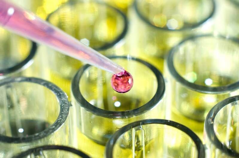So machen Sie Tests für Parasiten