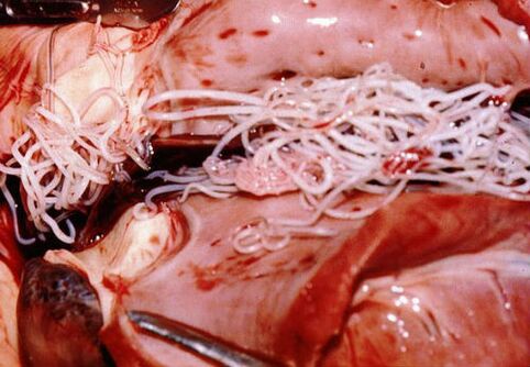 Parasiten im menschlichen Körper